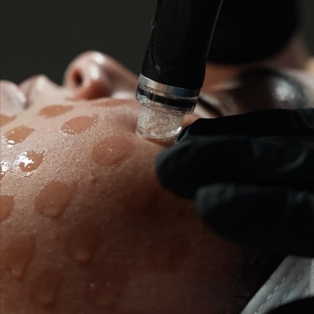 Lift & Glow at Finding Eden Aesthetics in Borger, TX